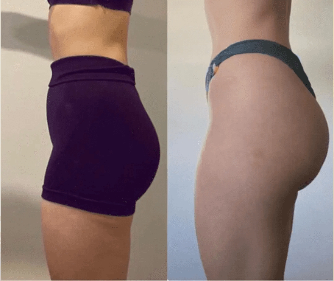 Transformacija 2