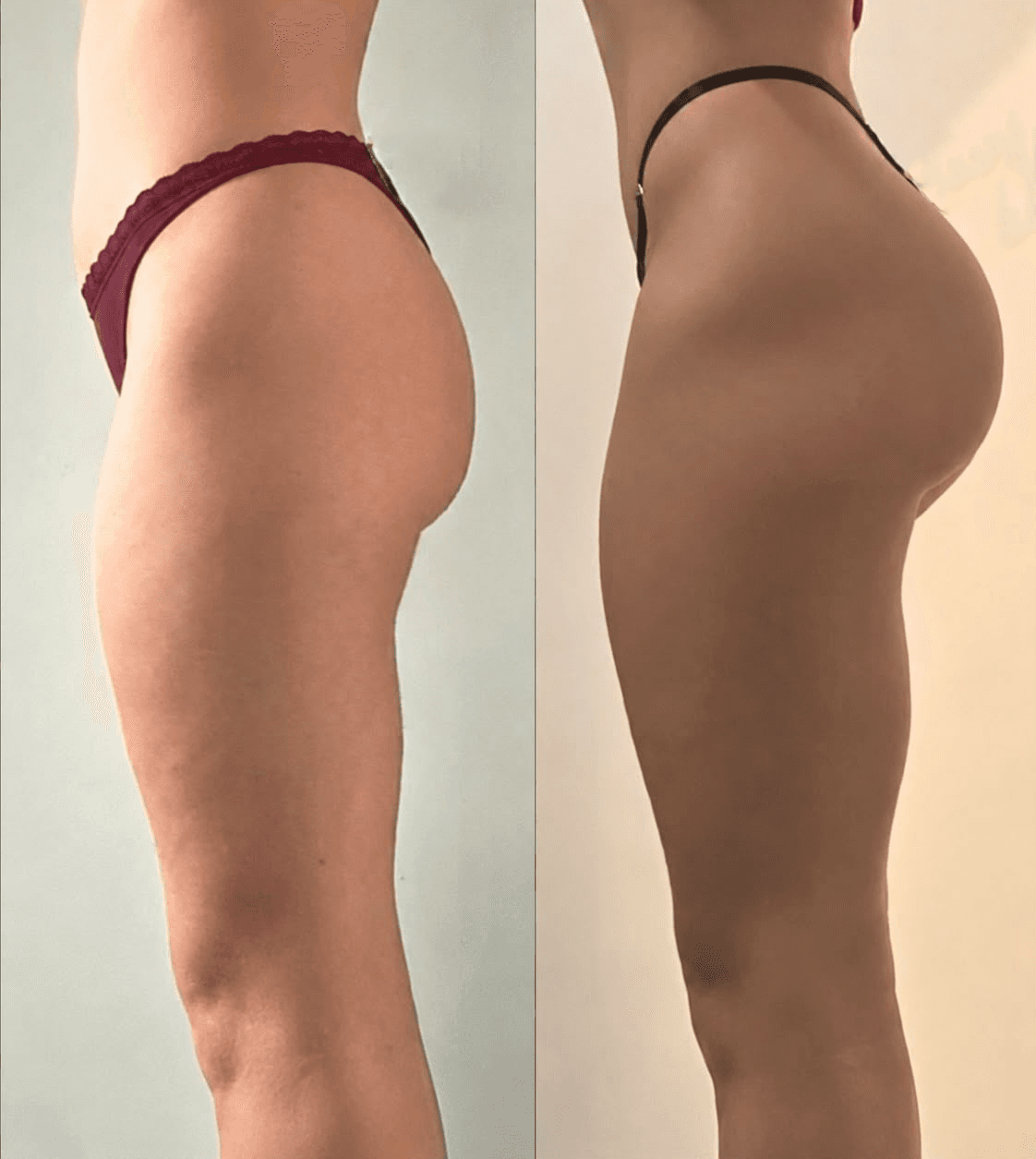 Transformacija 3